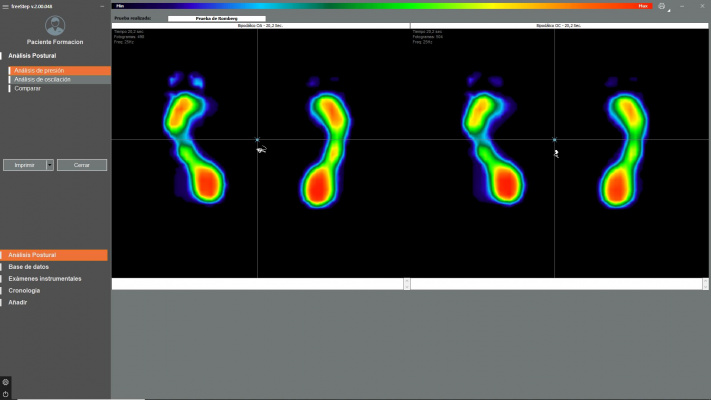 Módulo de Posturografía FreeStep 2.0