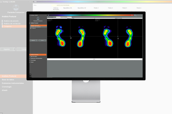 Módulo de Posturografía FreeStep 2.0
